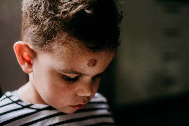 20180706-20180706-DSC_7114 Little boy with birthmark looks down during lifestyle newborn photography Perth session