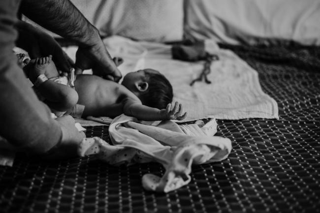 Black and white image of new baby in a nappy being changed on the hospital bed during Fresh 48 Photography Perth session