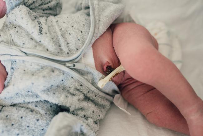 New baby's umbilical cord tie during a lifestyle newborn photography Perth session