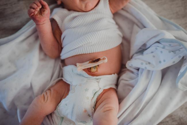 Belly button clamp during a Perth Fresh 48 photography session captured in home