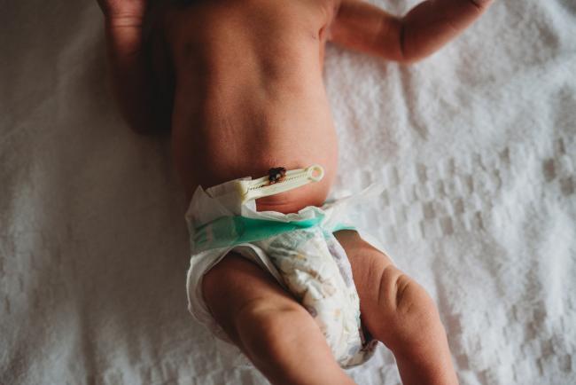 Close up of new baby belly button clamp during a Perth Fresh 48 photography session at SJOG Mt Lawley