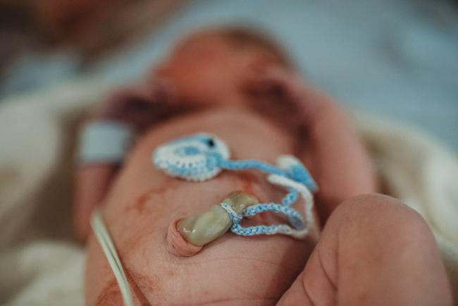 Baby's umbilical cord with Perth birth photographer at the Family Birthing Centre